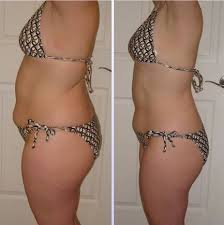 Here is my review of HCG For