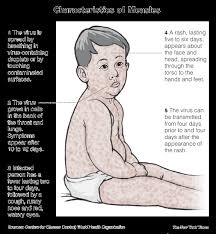Characteristics of Measles