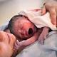 C-sections are increasing because we're messing with evolution, scientists say 