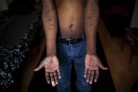 torture|COVID-19 exacerbated the risk of ill-treatment and torture worldwide | EEAS