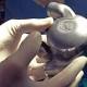 Brisbane bionic heart set to save lives - while missing a beat 