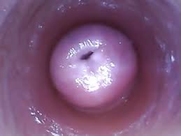 Endoscope porn endoscope anal endoscope anal videos eporner jpg x Endoscope anal