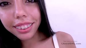 New braces fetish porn site brace faced jpg x Girls with braces