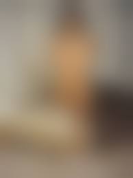 Amputee girls nude|AKHD double amputee beauty - ThisVid.com