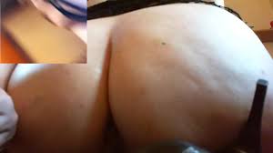 Endoscope camera inside anal videos free porn videos jpg x Endoscope anal