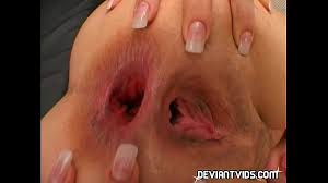 Gape anal jpg x Gape anal