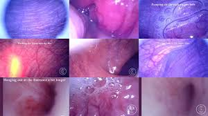 Endoscope trip in ass farts anal orgasm with contractions jpg x Endoscope anal