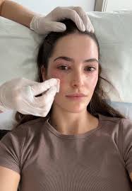 kimtaehee  fake nude|aegyo sal | beautifulbuns : a beauty, travel & lifestyle blog