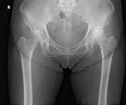 MRI まんこ|一般撮影(X線検査・レントゲン撮影）｜中央放射線部｜部門紹介｜診療部・部門紹介｜｜地方独立行政法人三重県立総合医療センター Mie  Prefectural General Medical Center