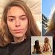 Anthea Page claims she got a staph infection from a makeup brush 