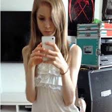 anorexic teens|Australian anorexic teenager was hospitalised eight times | Daily Mail  Online