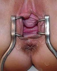 Vaginal speculum jpg x Vaginal speculum