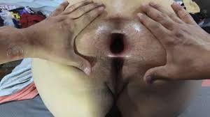 Big anal hole sex jpg x Big anus hole