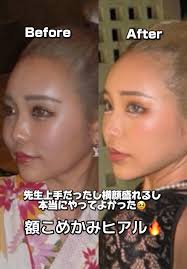 tokyohot 921|Hotel New Akao, Atami (updated prices 2025)