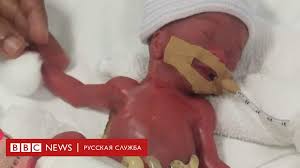 голые маленькие девочки child|35 см Аватар с закрытыми глазами голая девочка, которая светится, детская  игрушка-компаньон купить на OZON по низкой цене (884944184)