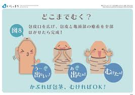 中学生包茎ちんこ|思春期までは放置を 「自然に亀頭が見える」 自治医大病院・中井教授に聞く 【子育て最前線】子どもの包茎 むくべきか｜はぐくもっと｜はぐくもっと｜下野新聞デジタル