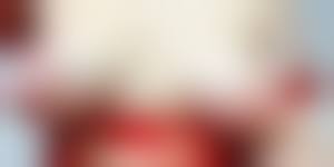 small tits very big areolas|Sexy s***l tits with big areola on a stripping solo girl - Zed Porn