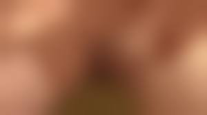 quad amputee nude|Quad Amputee Man - video 2 - ThisVid.com