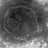 空気感染するはしか、厳戒の感染症 「免疫なし」なら容易に拡大 ...