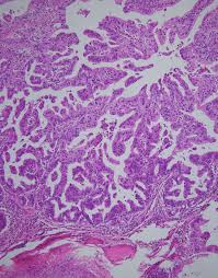 jeon jihyun fake nude|IJMS | October-2 2024 - Browse Articles