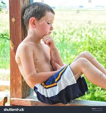 child in erection|Are baby erections normal?