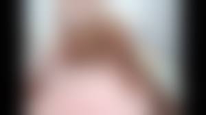 Amputee girls nude|Rule 34 - acerbi amputee blush bondage bondage breasts brown hair chains  collar female female leash looking at viewer navel nipples nude original  pussy quadruple amputee red eyes short hair solo uncensored | 1529081