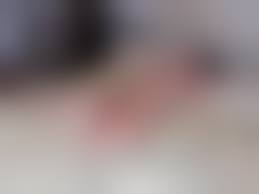 голые инвалиды|Голая девушка инвалид - порно фото topdevka.com