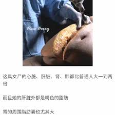 解剖女尸画像|腾讯视频】 法医解剖女尸找不到死因，哪料无意间碰到女尸脚底，诡异的一幕发生了