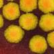 BBC News â€“ Rare 'polio-like' disease reports