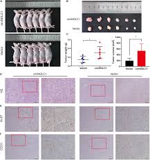 lsm nudes 020|Wnt-driven LARGE2 mediates laminin-adhesive O-glycosylation in human  colonic epithelial cells and colorectal cancer | Cell Communication and  Signaling | Full Text