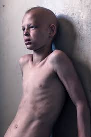 African  boys nude|Nude ebony boys and girls flashes, big picture #5.