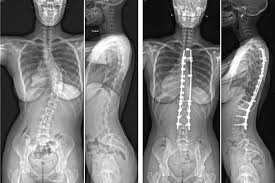 girls 16 year nude| /  X