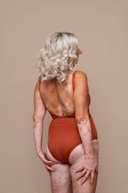 mature nude butt mature|Legs, Buttocks And Back Of A 40-year-old Woman With Stretch Marks,  Cellulite And Excess Weight On A White Isolated Background Stock Photo,  Picture and Royalty Free Image. Image 146104187.