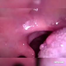 Uvula fetish jpg x Uvula fetish