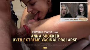Cervix uterus and vaginal prolapse luscious hentai manga porn jpg x Vaginal prolapse