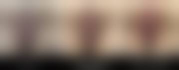 pussy before and after|What to expect after ThermiVa vaginal rejuvenation and how long does it  last? - Los Angeles California Medical Spa