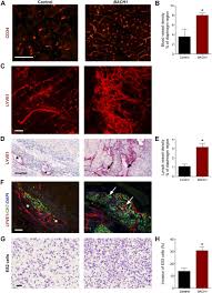 lsm nudes 020|Girls Nude - Nude Teen Photos, Erotic Pictures Teen 18