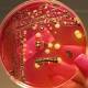 RPCI-led research team to share clinical results of entolimod drug at ASCO 2015 - News