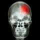 FDA Okays Marketing of First Cognitive Testing Devices for Patients With Head Injury 