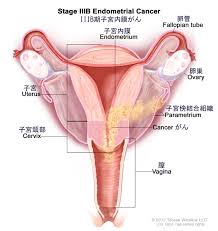 子宮姦|魔法少女の子宮にある濃い魔法パワーを餌にして育つ触手の子」(えらい) | エロ漫画無料同人イベントDLsiter