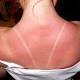 Treated paper warns users of impending sunburn 