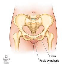 pubis spread|Mons Pubis - an overview | ScienceDirect Topics