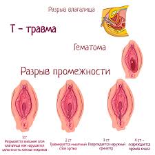 разрыв пизды|Разрыв пизды крупным планом толстой женщины (61 фото) - порно и эротика  HuivPizde.com