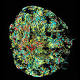 Kidneys in a dish: Melbourne researchers use stem cells to grow tiny organs 