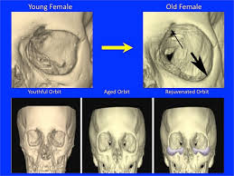 Your Facial Bone Structure Has a Big Influence on How People See