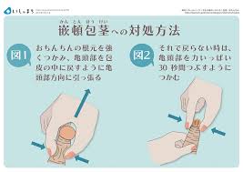 中学生包茎ちんこ|中学生の包茎は放っておいて大丈夫？多い悩みや代表的な治療方法 - アトムクリニック - atom-clinic