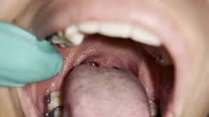 Uvula fetish jpg x Uvula fetish