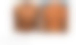 mini tits|Small Boob Job: Subtle Enhancements for a Natural Look