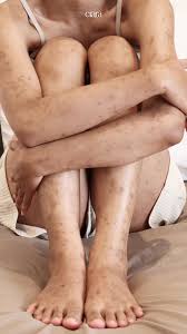 alea nova telanjang|Cerita Nova Eliza Tinggalkan Anak di Kampung - ShowBiz Liputan6.com