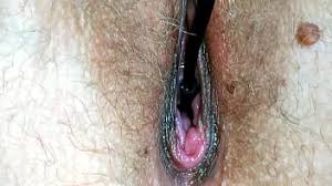 Endoscope anal jpg x Endoscope anal